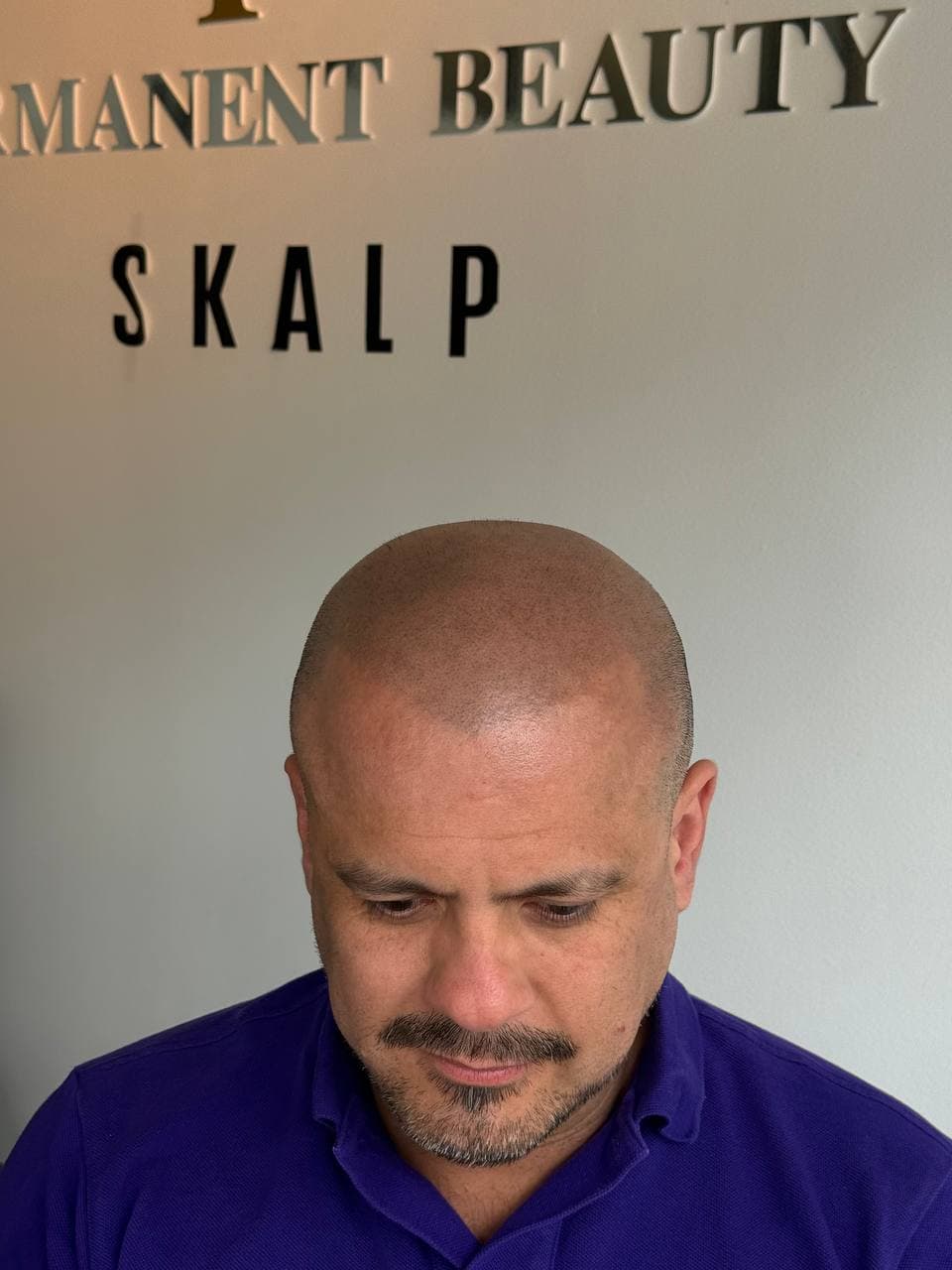 Ferdig SMP-resultat fotografert forfra