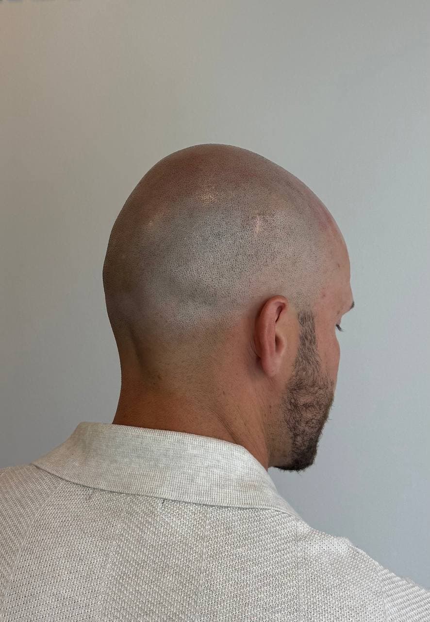 Ferdig SMP-resultat fotografert bakfra