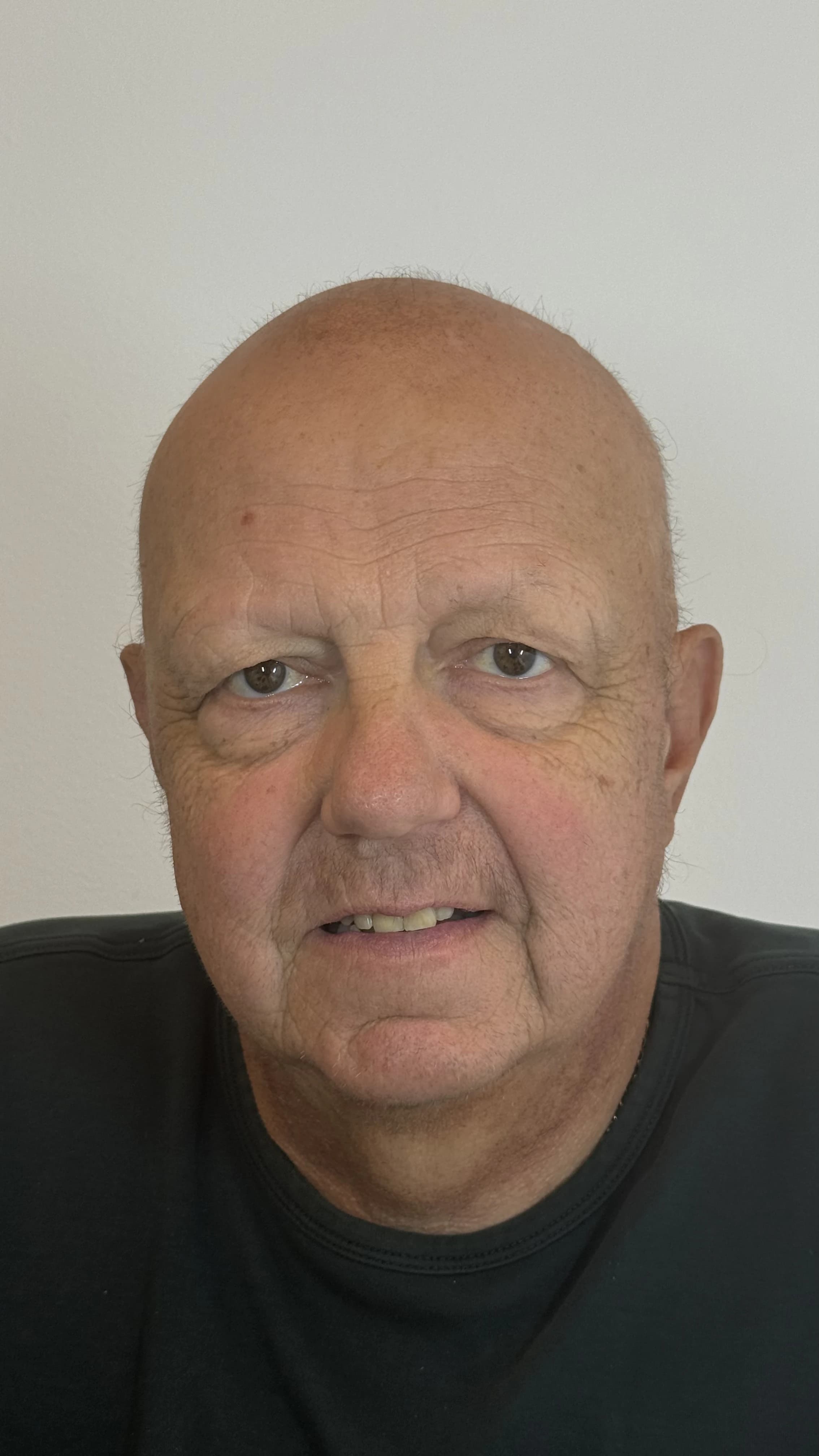 Kunde før behandling